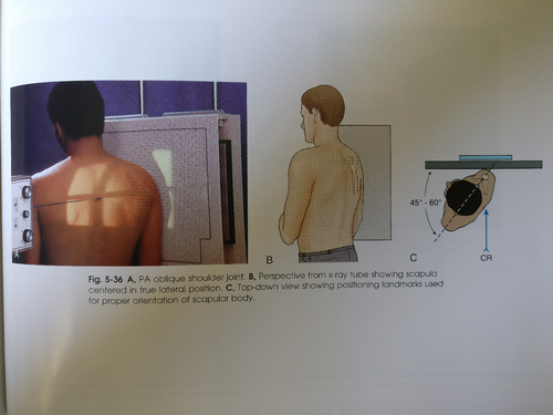<p>position: patient should be erect, patient PA, then rotate affected shoulder into a 45-60 posterior oblique. unaffected arm should be up in front of patient, affected arm down</p><p></p><p>IR: portrait</p><p></p><p>breathing technique: suspend during exposure</p><p></p><p>technique: 70-85, 15-25 mas</p><p></p><p>SID: 40</p><p></p><p>CR: perpendicular to scapulohumeral joint</p><p></p><p>marker: correct marker on correct side</p>