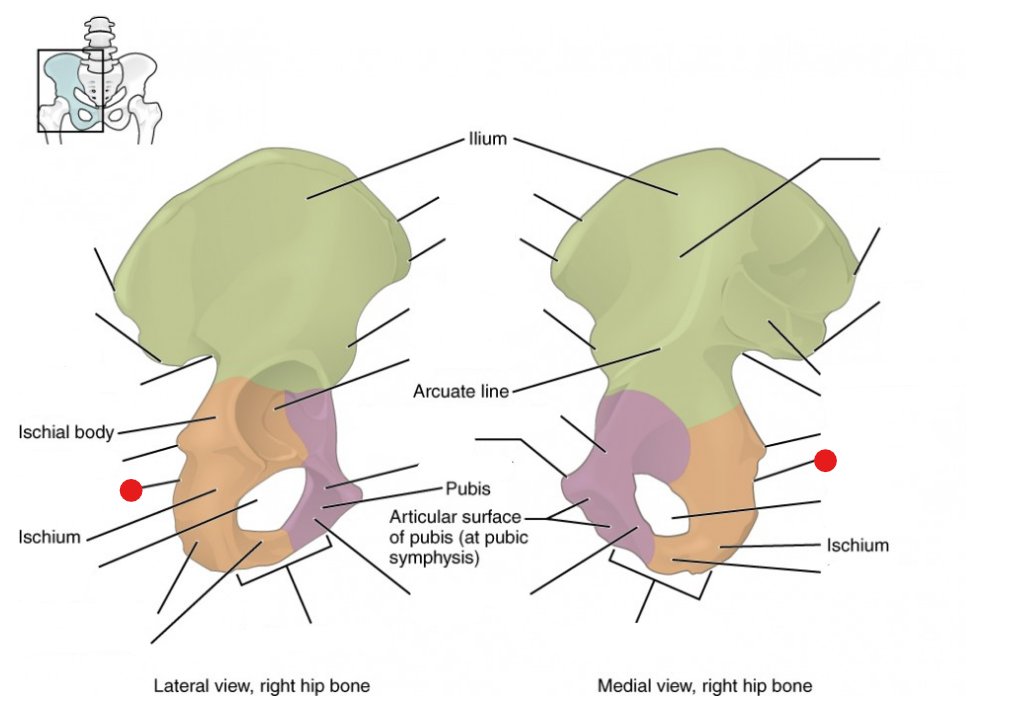 <p>Identify the structure pinned</p>