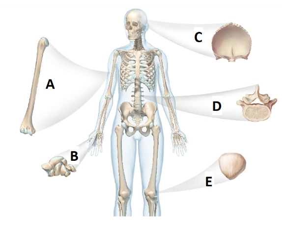 <p>type of bone shape D</p>