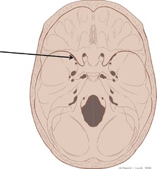 <p>exit for ophthalmic division, oculomotor nerve, trochlear nerve, and abducent nerve</p>
