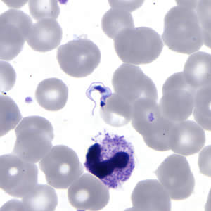 <ul><li><p><strong><u>vector</u></strong>: kissing bugs</p></li><li><p>transmission can also occur through blood transfusion, transplant, or congenitally</p></li><li><p><strong><u>diagnosis</u></strong>: C-shaped trypomastigotes found in thick and thin blood smears and body fluids</p></li></ul><p></p>