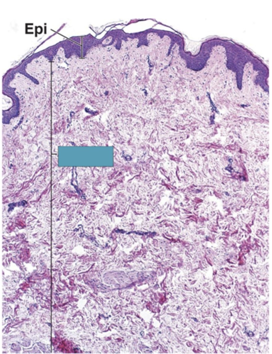 <p>Identify the layer of the skin</p>