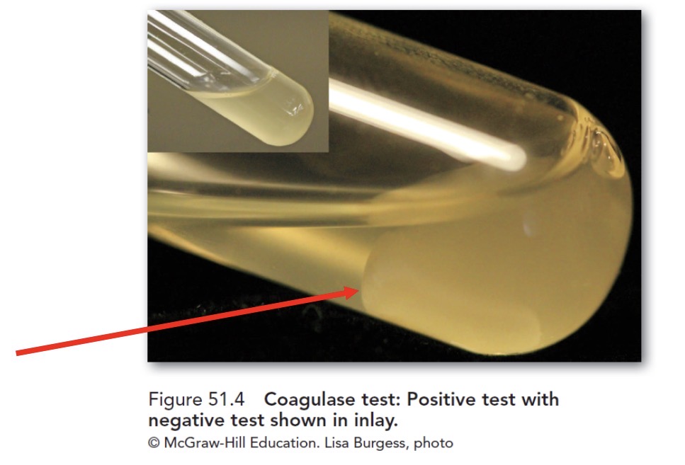 <p>Coagulase test</p>