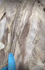 <p>Name the Muscle</p><p>- I Love Science</p><p>- ILS lateral to medial</p><p>- right next to spinous processes</p>