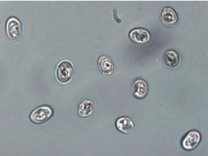 <p><em>Cryptosporidium:</em> Diagnosis</p>