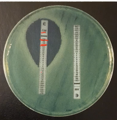 <ul><li><p>Spread bacteria on plate</p></li><li><p>Strips have different levels of ABX in them</p></li><li><p>Able to see <strong>minimum concentration inhibiting bacteria</strong></p></li></ul><p></p>