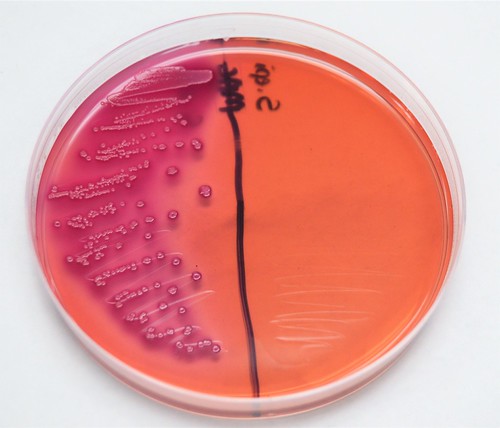 <p>The left side of the MacConkey Agar plate shown above shows an organism&nbsp; that is __________ for ____________ fermentation.&nbsp;</p>