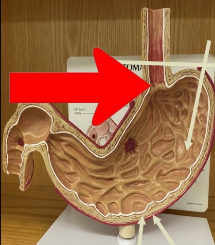 term image
