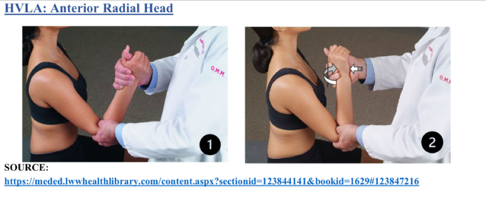 <ol><li><p>Pt seated, physician stands facing pt</p></li><li><p>Thumb on anterior head</p></li><li><p>Other hand is shaking hands</p></li><li><p>Rotate forearm into pronation until barrier</p></li><li><p>Flex into barrier</p></li><li><p>Thrust is a flex from hand holding wrist</p></li></ol><p></p>