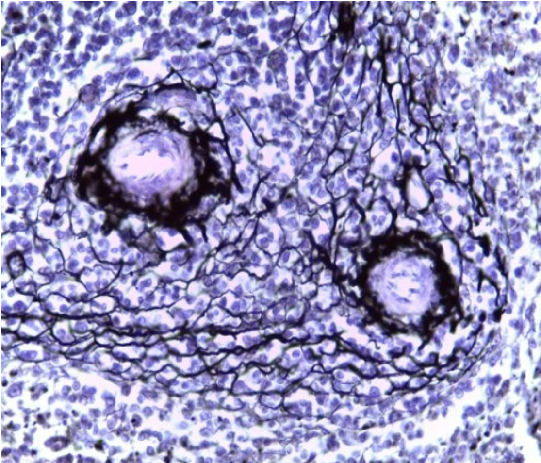 <p>Reticular Connective Tissue</p>
