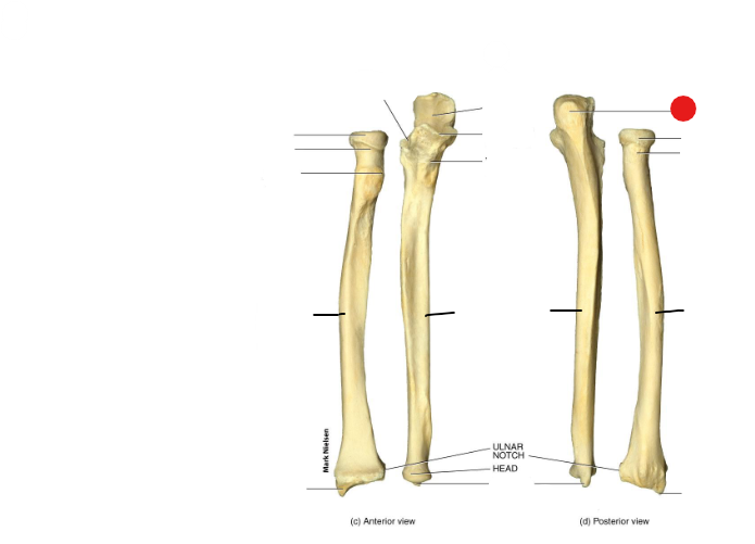 <p>Identify the structure pinned</p>