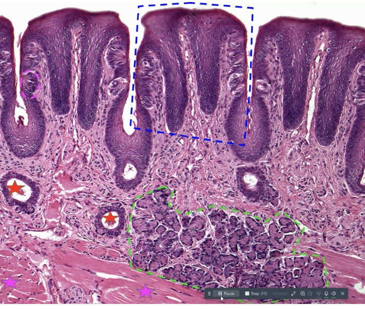 <p>what is the pink star? what does it do </p>