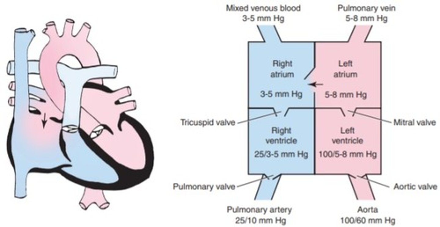 <p>a. Atrial septal defect</p><p>b. Hypoplastic left ventricular syndrome</p><p>c. Patent ductus arteriosus</p><p>d. Atrioventricular canal defect</p>