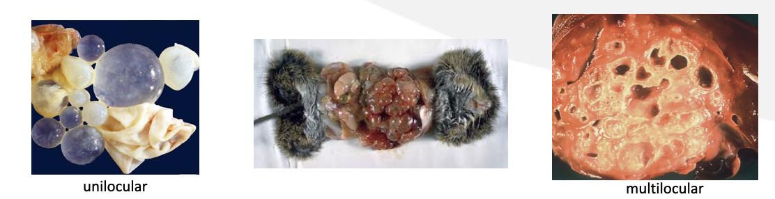 <p>What type of metacestode stage is this? </p>