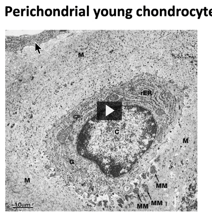 <p>It’s interesting because if I go to this image, which is an electron micrograph, we can see this small cell, where I’m pointing at with the mouse cursor, this cell is a fibroblast. This means that this is a young chondrocyte, it is a product of that appositional growth mechanism we discussed earlier, sourced from perchondrium. In a similar manner, another cell, is a chondroblast </p>