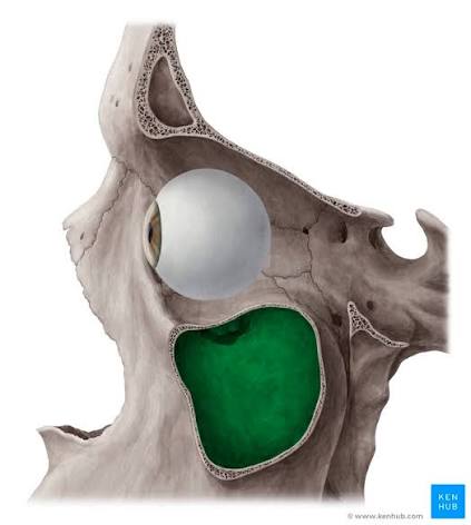 <p>which sinus is this in the green</p>