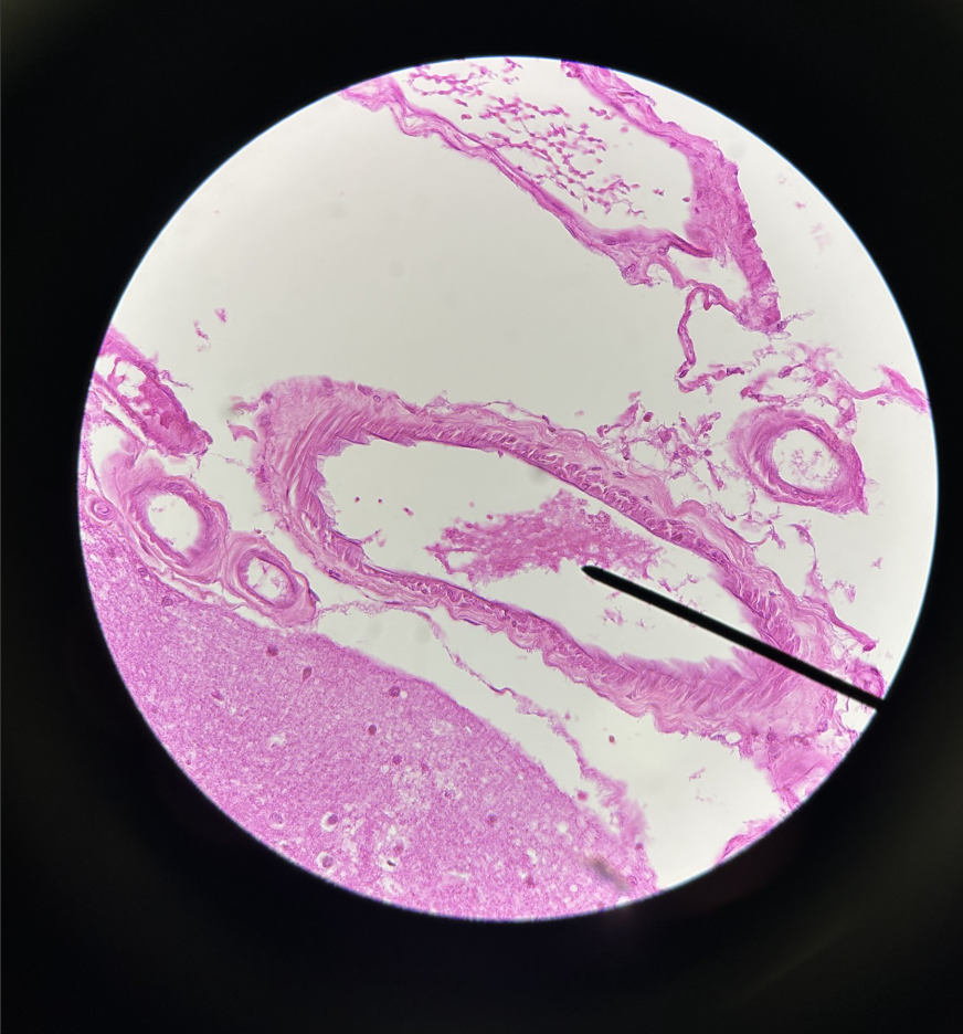 term image