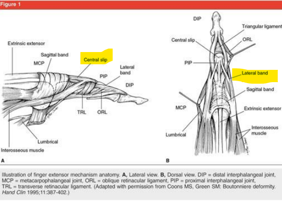 <p><span style="color: blue;"><strong>Extend the PIP &amp; DIP joints</strong></span></p><ul><li><p>After leaving MCP joint, the EDC tendon splits into the central slip &amp; 2 lateral bands</p></li></ul><p></p>