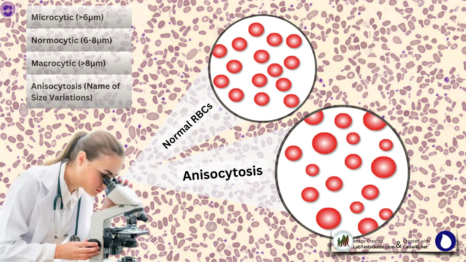 <p>Anisocytosis</p>