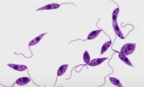 <ul><li><p>protozoa </p></li><li><p>causes kala-azar</p></li></ul><p></p>