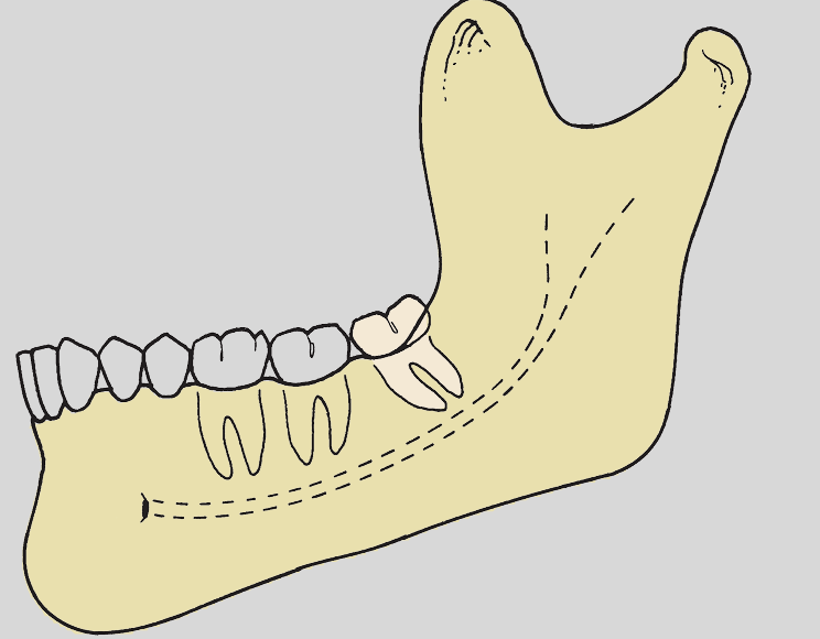 <p>what is the PG classification?</p>