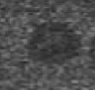 <p>Less echogenic, darker than another structure</p>