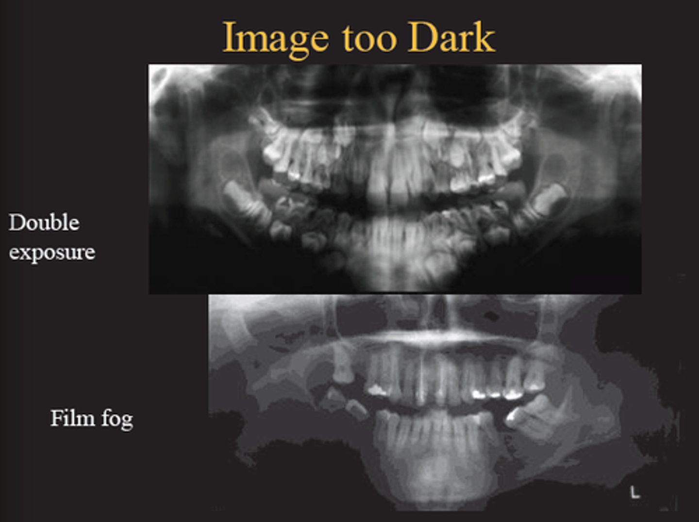 <p>What causes an image to be too dark?</p>