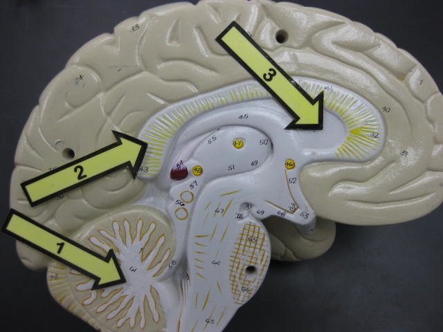 <p>Identify 1, 2 and 3? </p><p>Lab Image 10-8</p>