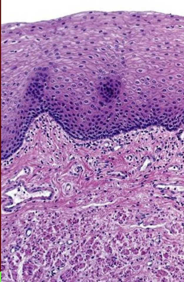 <p>What type of muscle os this?</p>