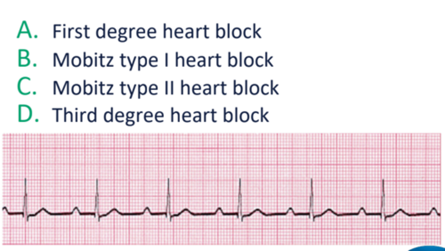 <p>first degree heart block; Continue exercising at the current intensity without any modifications</p>