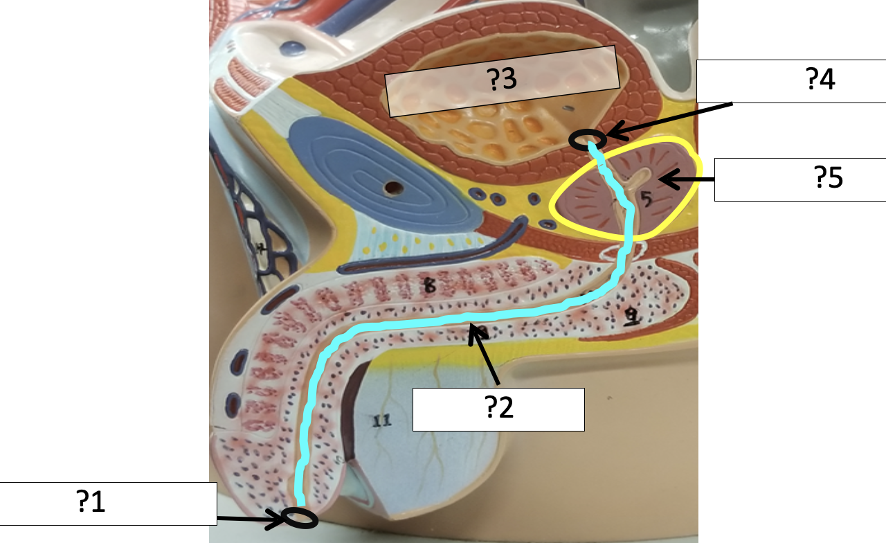 <p>1 Name the hole?</p>