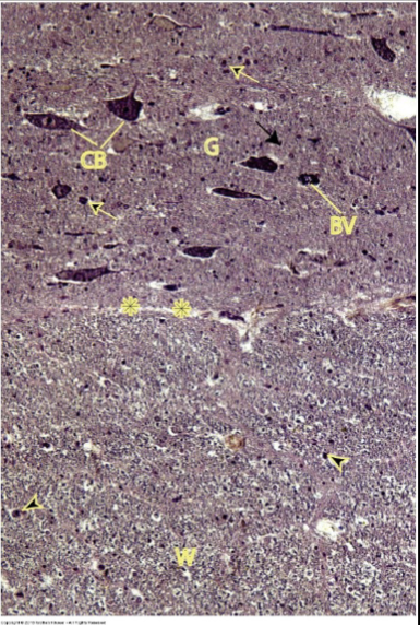 <p>in the Spinal cord, what does its White matter contain?</p>