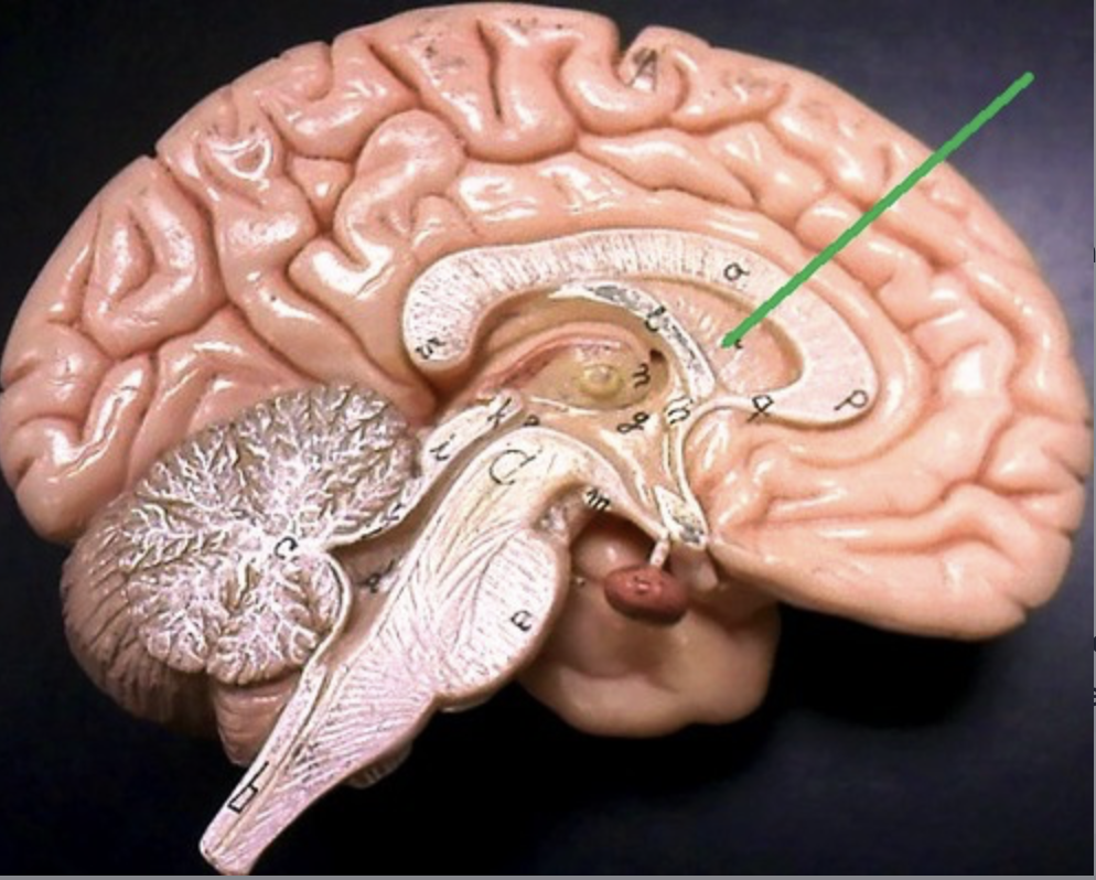 <p>membrane between lateral ventricles</p>