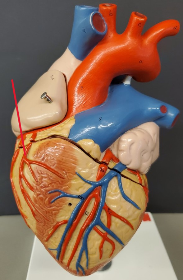 <p>Name the artery</p>