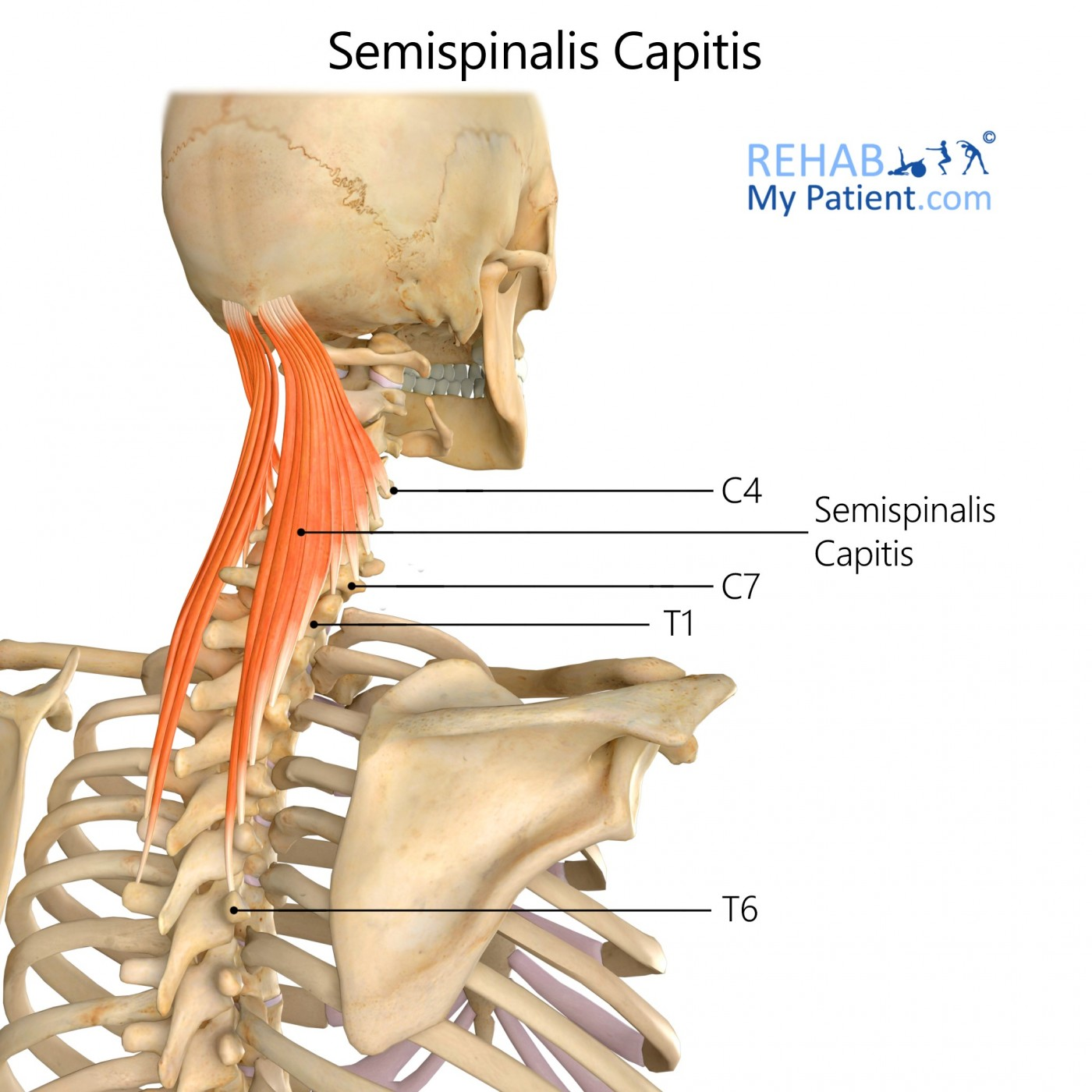 <p>semispinalis capitis</p>