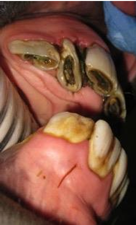 <ul><li><p>Usually cause little problem</p></li><li><p>Often best not to remove</p></li></ul><p></p>