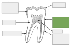 <p>line between the cementum and enamel, a lot of people have calculus built up around this area, it is horizontal around the tooth and also called the cervical line</p>