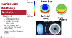 <p>How are peri-ballast lenses stabilized?</p>