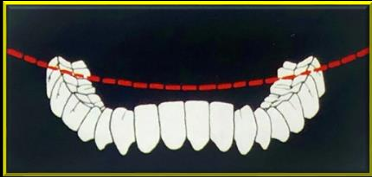<p>-mediolateral curve that contacts the buccal and lingual cusp tips on each side of the arch</p>