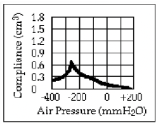 <p>What tympanogram would you see with an individual with an obstructed Eustachian tube?</p>