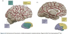 <p>Middle Cerebral Artery; affects upper extremities.</p>