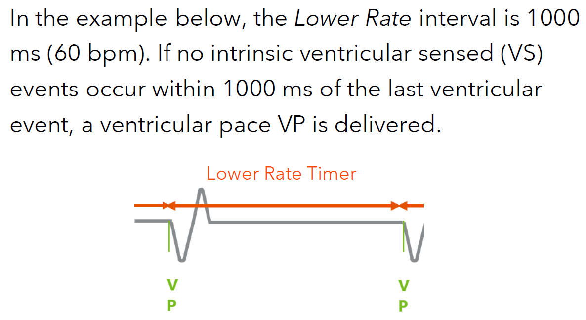 <p>which determines the device’s minimum pacing rate. </p><p>If this interval expires before an intrinsic depolarization is sensed, the device will deliver a paced event in that chamber</p>