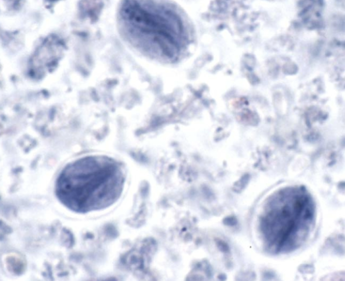 <p>What protist/cyst is this?</p>