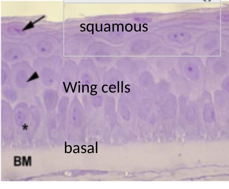 <p>wing cells, basal cells, squamous cells </p>