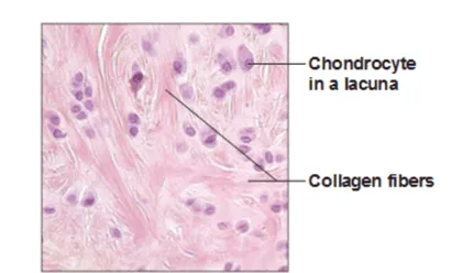 <p>what type of cartilage is this?</p>
