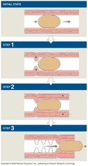 <p>It consists of two layers of muscle that facilitate peristalsis.</p>