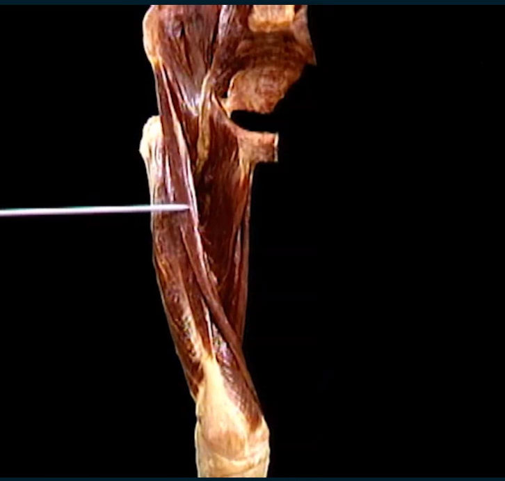 <p>Diep, anterior zicht</p>