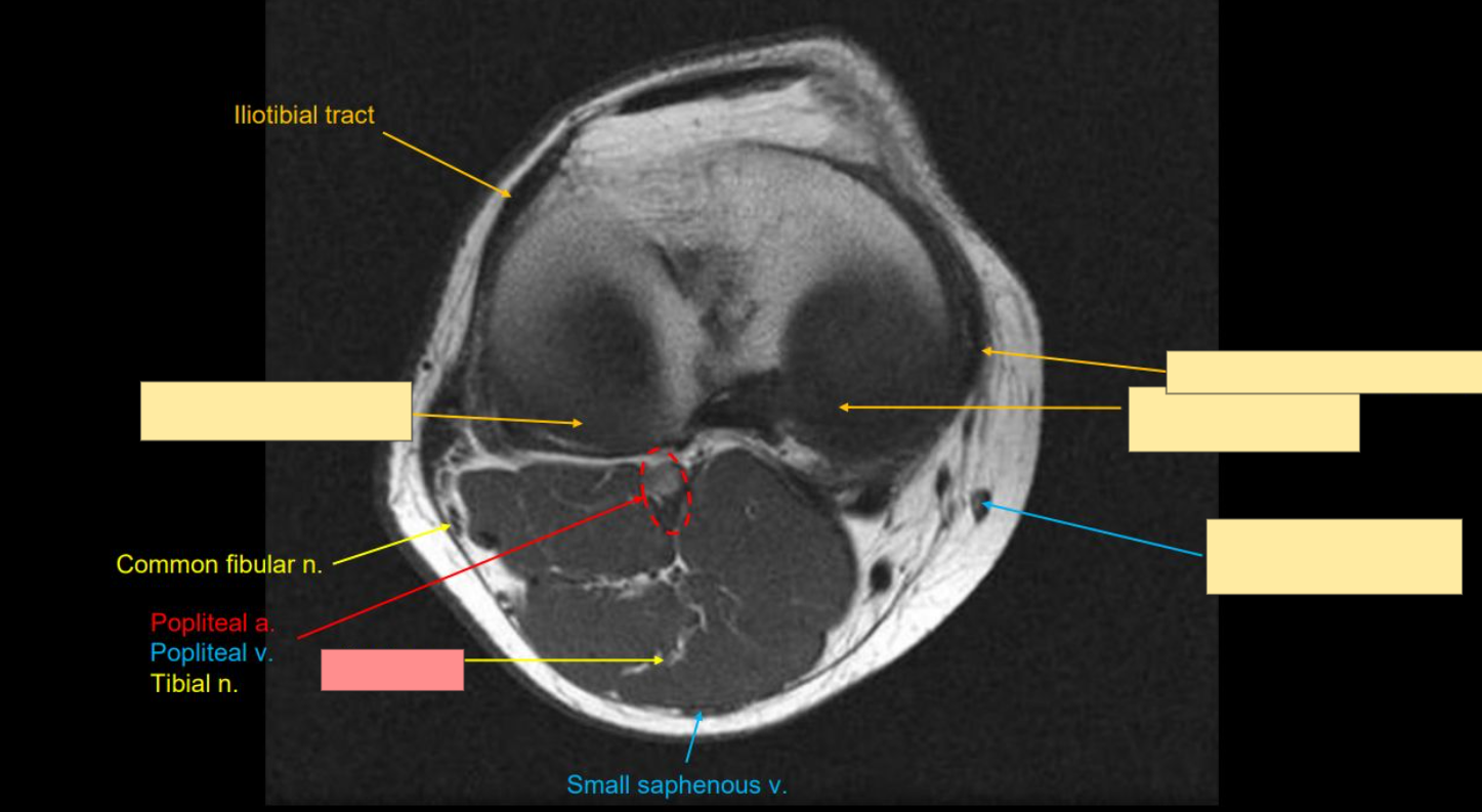 <p>Identify the structure</p>
