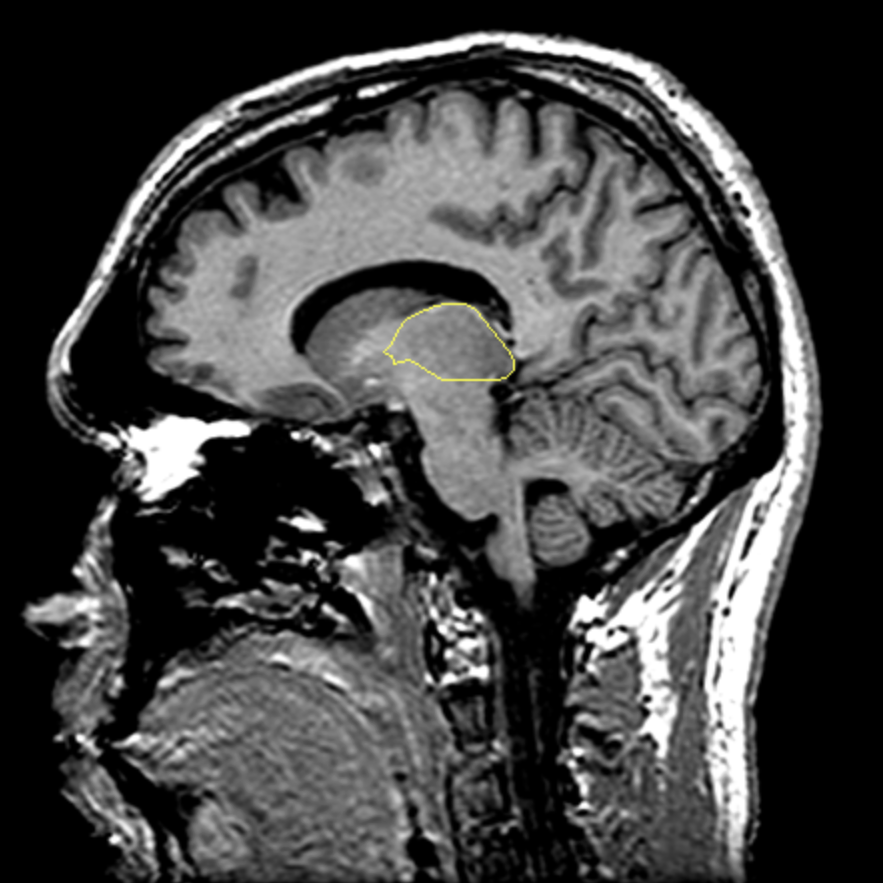 <p>What is the area highlighted called?</p>