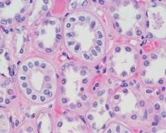<p>Description: single layer of cubelike cells with large, spherical central nuclei</p><p>Function: secretion and absorption</p><p>Location: kidney tubules, ducts and secretory portions of small glands, ovary surface</p>